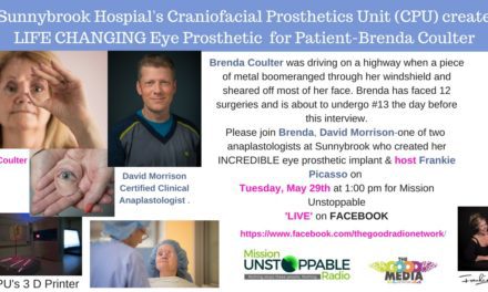 Brenda Coulter’s Life Changing Surgery- Thanks to Sunnybrook Hospitals Cranial Prosthetics Unit